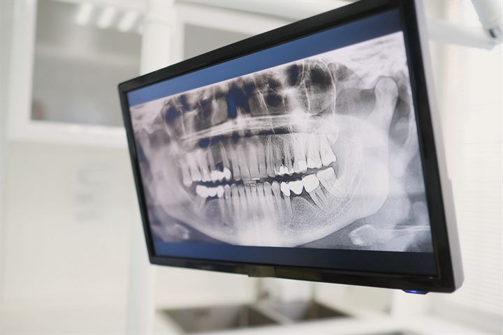 Radiografía dental panorámica en una pantalla de la clínica